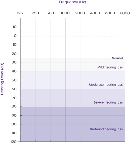 hearing-loss-categorisation