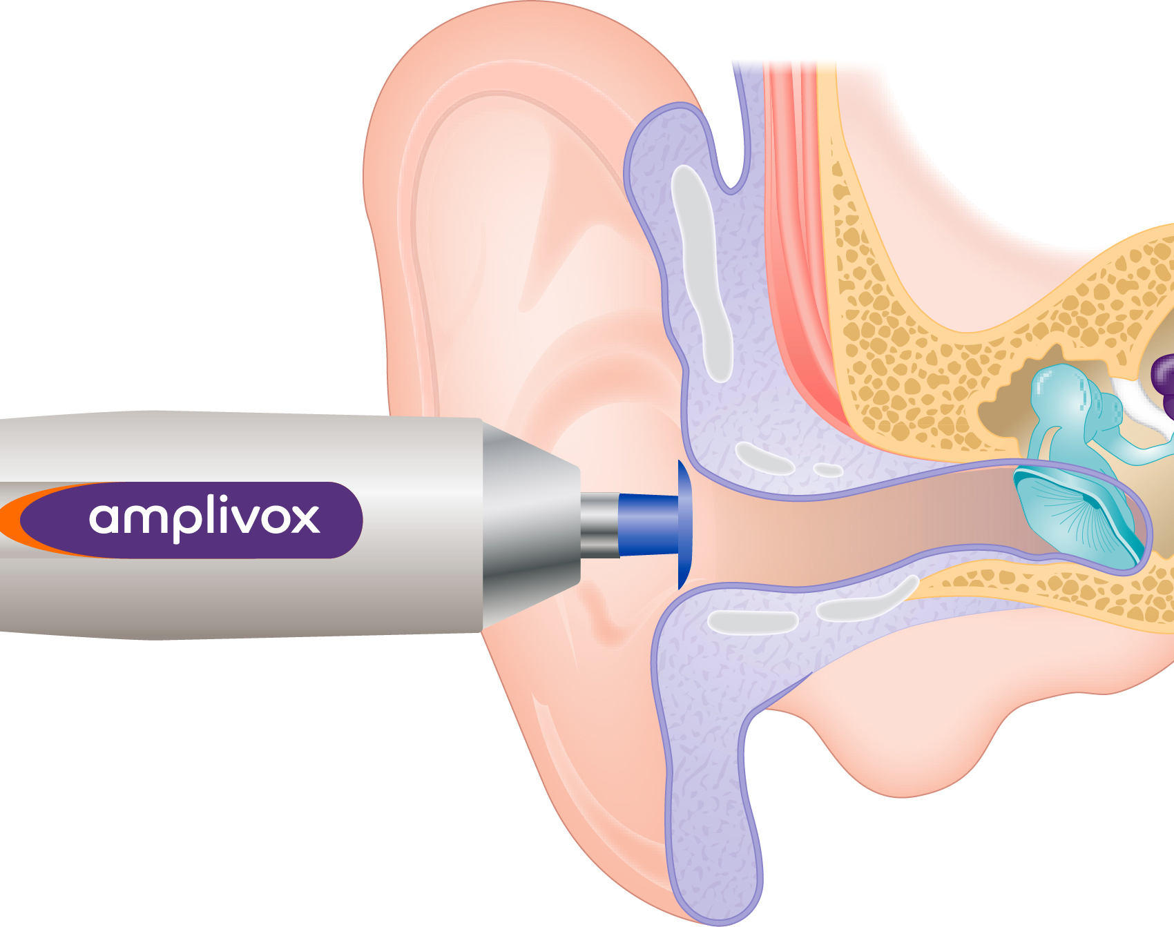 umbrella-tip---correct-size